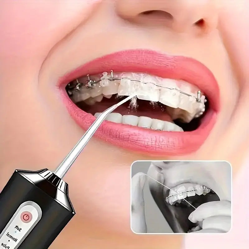 Limpiador de dientes - Irrigador dental